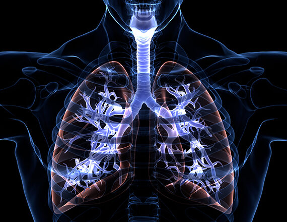 Syndroom Van Sarcoïdose - Deel 4