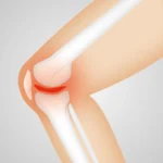 Uitslag van mijn knie-MRI