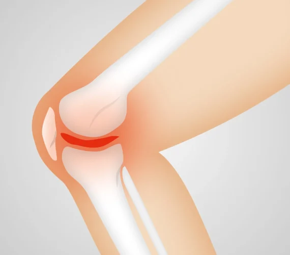 Uitslag van mijn knie-MRI